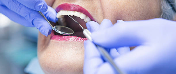 Best Dental Abscess Treatment in Palm Shores, FL